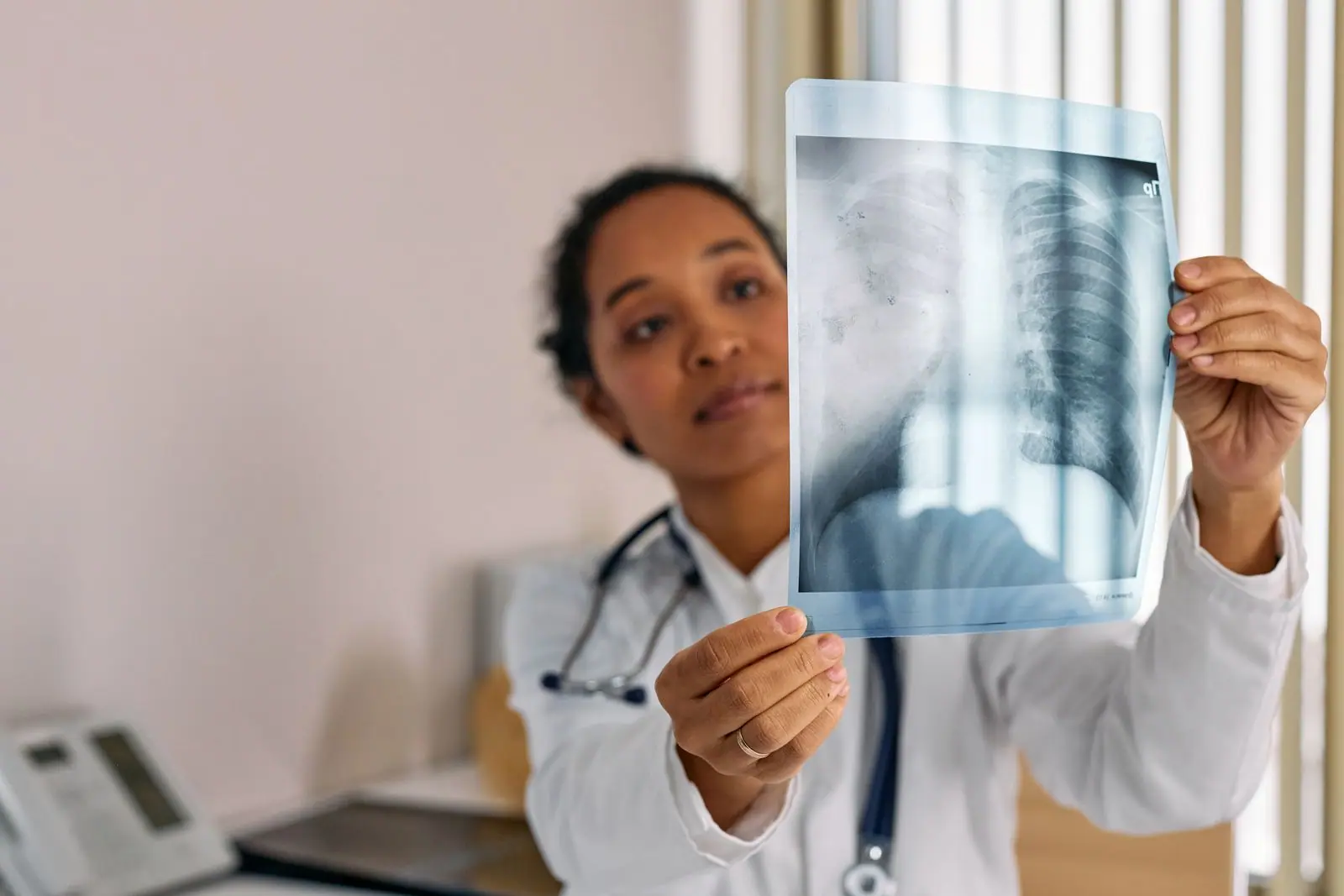Médecin analysant une radiographie pulmonaire