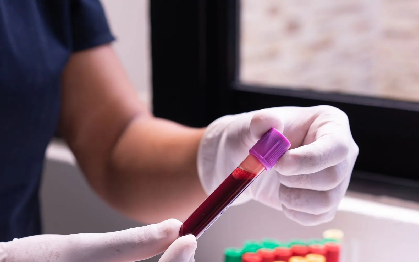 Échantillon sanguin en tube pour un dosage de laboratoire